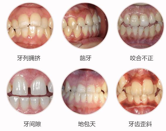 牙齿不健康可以进行正畸治疗吗？