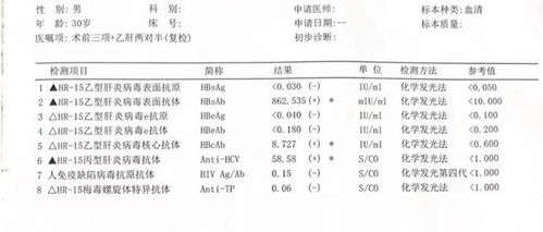 丙型肝炎有什么症状吗