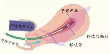 孕检可以挂生殖医学科吗