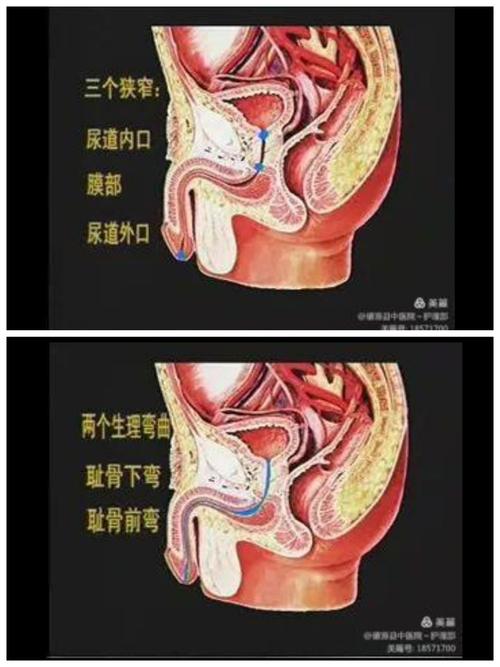 女性尿道炎症状表现及用药方法