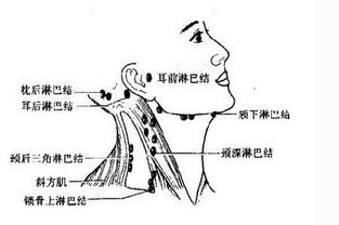 9 15世界淋巴瘤日丨正确认识淋巴结肿大的信号