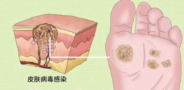 年级高中生（10-12年级）