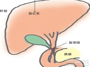 胆囊息肉偏方在职场中的应用与汇报策略