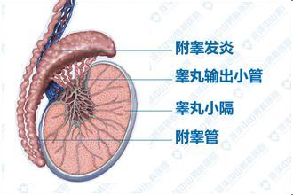 急性附睾炎症状消退但没消肿