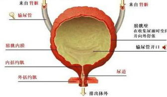 急性膀胱炎的症状吃什么药